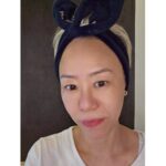 水光ピール×リジュランでふっくらツヤ肌