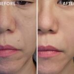 肌の変化は5年ごとにやってくる？