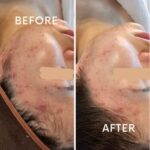 肌が変わり始めるサインって？