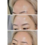 ピーリング後にやるといいこと、よくないこと