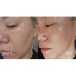 肌は何歳からでも変えられる