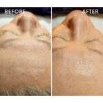 結果が出ない施術に共通する“落とし穴”