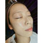 まずは“水光ピーリング”から始める理由