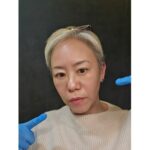 迷ったら水光ピールから