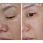 水光肌は作れます