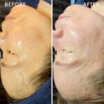 エステに踏み出せない方へ